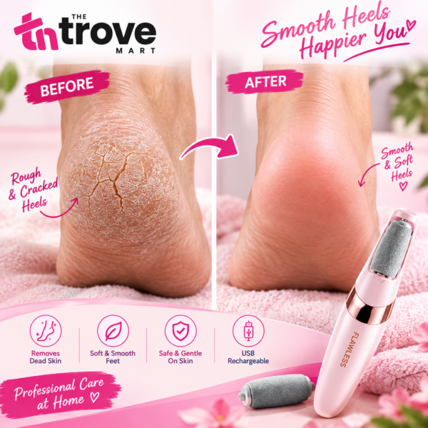 Electric callus remover