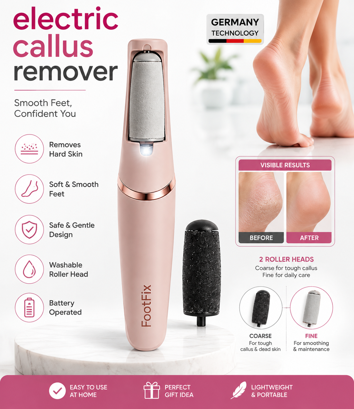 Callus Remover